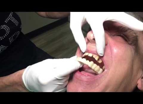 Dentist Practice Loans – Call 904-551-6090:  Houston Cosmetic Dentist: Snap-on Smile and Men..chipped, gaps, yellow teeth