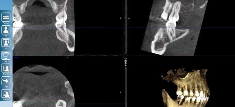 Dentist Practice Loans – Call 904-551-6090:  CBCT at Crown Pointe Dentistry