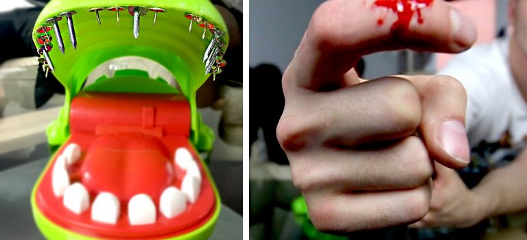 Dentist Practice Loans – Call 904-551-6090:  EXTREME CROCODILE DENTIST ft. NAILS (BLOOD ALERT)