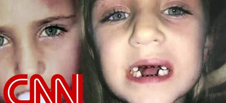 Dentist Practice Loans – Call 904-551-6090:  Dentist accused of abusing children, unwanted procedures