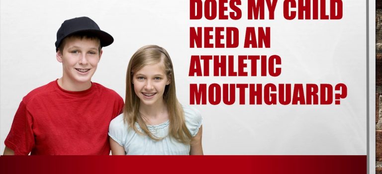 Dentist Practice Loans – Call 904-551-6090:  Mouthguards in Palm Harbor, FL – Harp Pediatric Dentistry