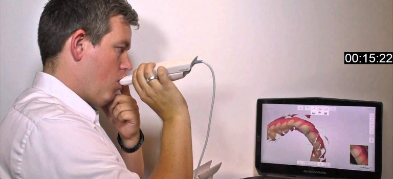 Dental Practice Financing For Dentists – Call BRT: 904-551-6090:  Insane speed-scanning with 3Shape TRIOS 3 intraoral scanner