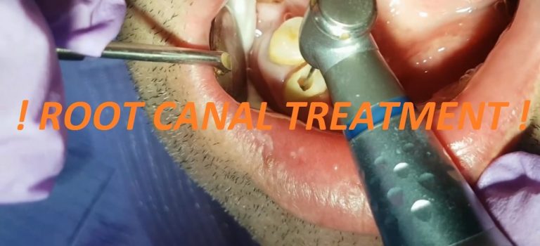 Dental Practice Financing For Dentists – Call BRT: 904-551-6090:  ROOT CANAL TREATMENT !!!