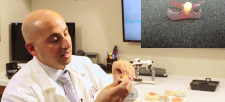 Dental Practice Financing For Dentists – Call BRT: 904-551-6090:  What are alternatives to implants? | Daniel Daniel Dentistry | 902.404.3368