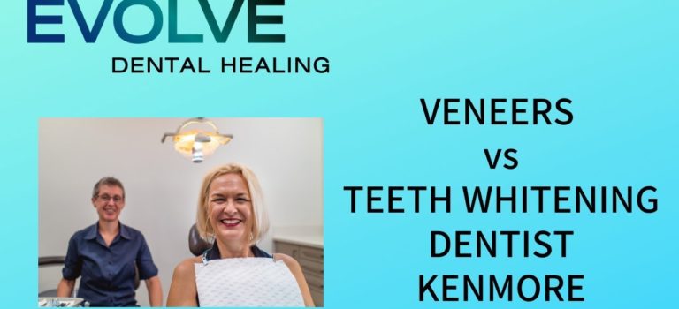 Dental Practice Financing For Dentists – Call BRT: 904-551-6090:  Should You Get Dental Veneers or Teeth Whitening [Dentist Kenmore]