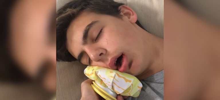 Dental Practice Financing For Dentists – Call BRT: 904-551-6090:  STRAIGHT OUTTA DENTIST Funny wisdom teeth aftermath videos 2018