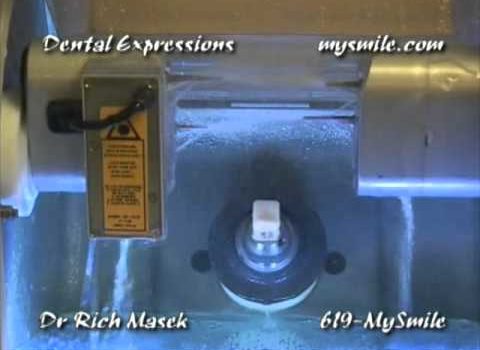 Dental Practice Financing For Dentists – Call BRT: 904-551-6090:  CEREC Esthetic Dentistry at Dental Expressions by Dr Rich Masek