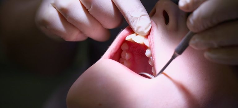 Dental Practice Financing For Dentists – Call BRT: 904-551-6090:  Dealing with anxiety at the dentist