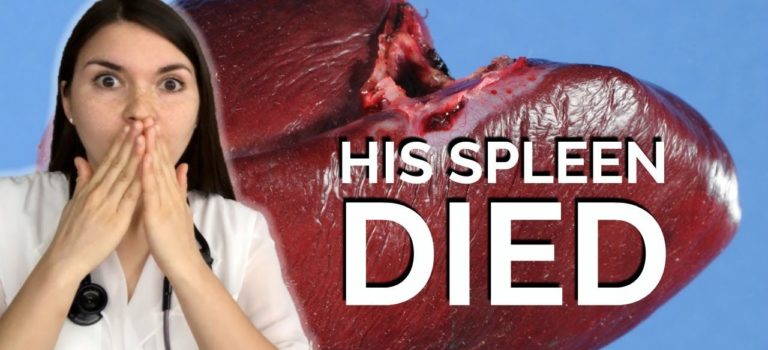 Dental Practice Financing For Dentists – Call BRT: 904-551-6090:  DOCTOR STORY TIME: His Spleen DIED After A DENTIST Appointment