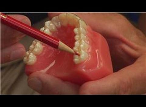 Dental Practice Financing For Dentists – Call BRT: 904-551-6090:  Tooth & Gum Abscesses : How Dentists Drain an Abscessed Tooth