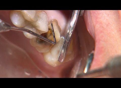 Dental Practice Financing For Dentists – Call BRT: 904-551-6090:  Chairside Live Episode 257:The Most Efficient Dentistry of Your Career