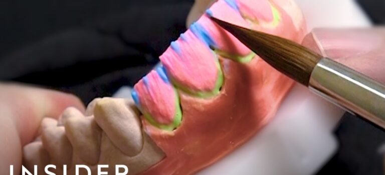 Dental Practice Financing For Dentists – Call BRT: 904-551-6090:  How This Dentist Crafts $80,000 Veneers For Celebrities | Beauty Explorers