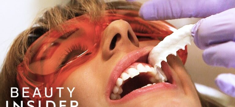 Dental Practice Financing For Dentists – Call BRT: 904-551-6090:  The Fastest Way Dentists Whiten Teeth | Beauty Explorers