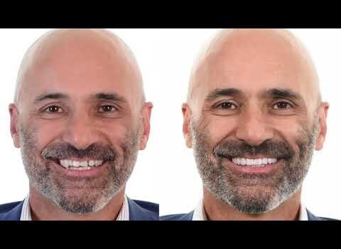 Dental Practice Financing For Dentists – Call BRT: 904-551-6090:  Cosmetic Dentistry – The Difference Is In the Detail™