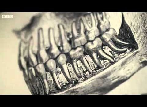 Dental Practice Financing For Dentists – Call BRT: 904-551-6090:  BBC Drills – Dentures and Dentistry An Oral History