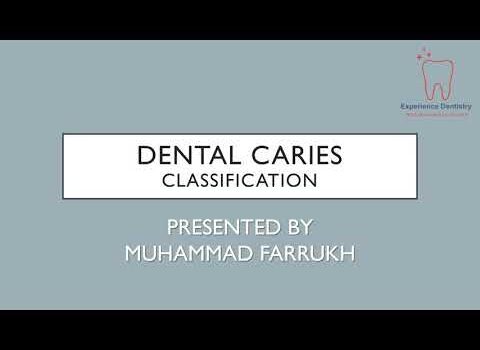 Dental Practice Financing For Dentists – Call BRT: 904-551-6090:  Classification Of Dental Caries #DentalCaries #Caries #Dentistry #BDS #Dentist #OperativeDentistry