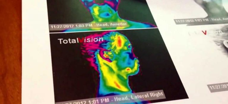 Dental Practice Financing For Dentists – Call BRT: 904-551-6090:  Thermography and Dentistry