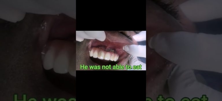 Dental Practice Financing For Dentists – Call BRT: 904-551-6090:  Dental News Show. November-December 2013