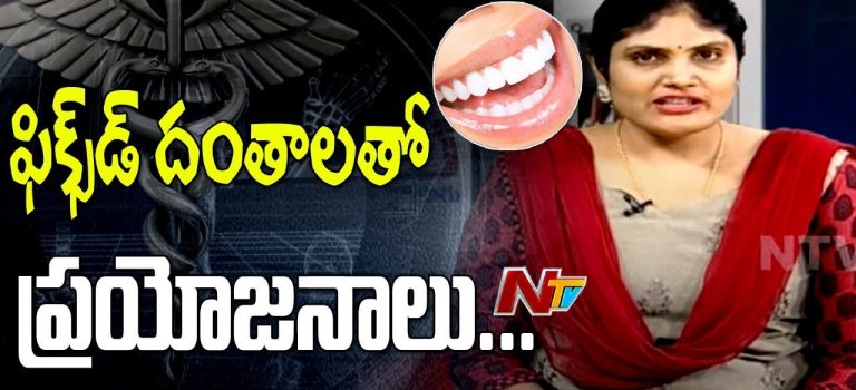 Dental Practice Financing For Dentists – Call BRT: 904-551-6090:  Restore Your Smile with Dental Implants – Surgery, Advantages || Hello Doctor | NTV