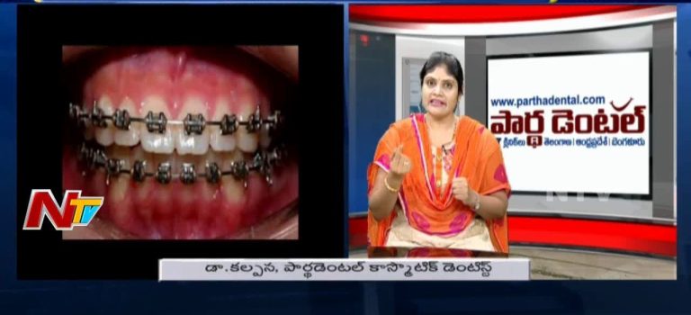 Dental Practice Financing For Dentists – Call BRT: 904-551-6090:  Fixed Dental Implant | Treatment Options: Removable vs Permanent Teeth on Implants | Hello Doctor