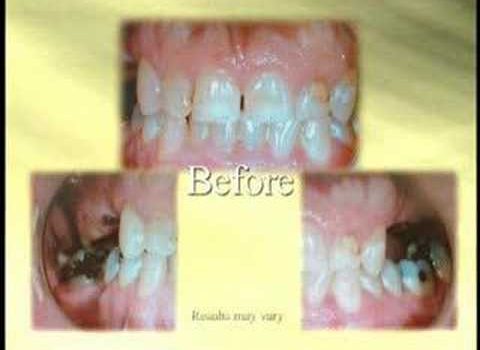 Dental Practice Financing For Dentists – Call BRT: 904-551-6090:  Thomas Gonzales DDS on the Medical News Network Part 2 of 3