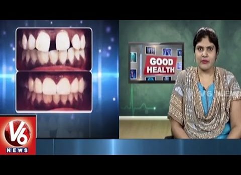 Dental Practice Financing For Dentists – Call BRT: 904-551-6090:  Dental Problems | Reasons & Treatment | Partha Dental Hospital | Dr Kalpana | Good Health | V6 News