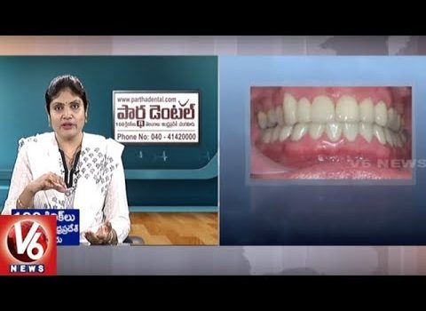 Dental Practice Financing For Dentists – Call BRT: 904-551-6090:  Dental Problems | Reasons And Treatment | Partha Dental Hospital | Good Health | V6 News