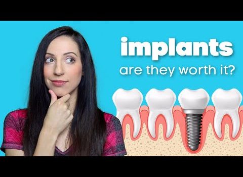 Dental Practice Financing For Dentists – Call BRT: 904-551-6090:  Dental Implant Procedure Options