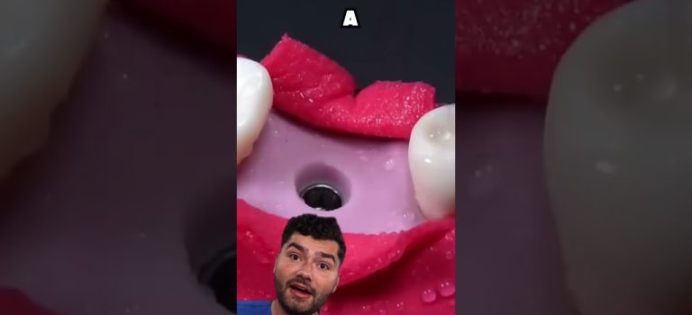 Dental Practice Financing For Dentists – Call BRT: 904-551-6090:  6 Things your Dentist May NOT tell you about All on 4 or a Full Set of Dental Implants Dental Practice Financing For Dentists – Call BRT: 904-551-6090:  6 Things your Dentist May NOT tell you about All on 4 or a Full Set of Dental Implants